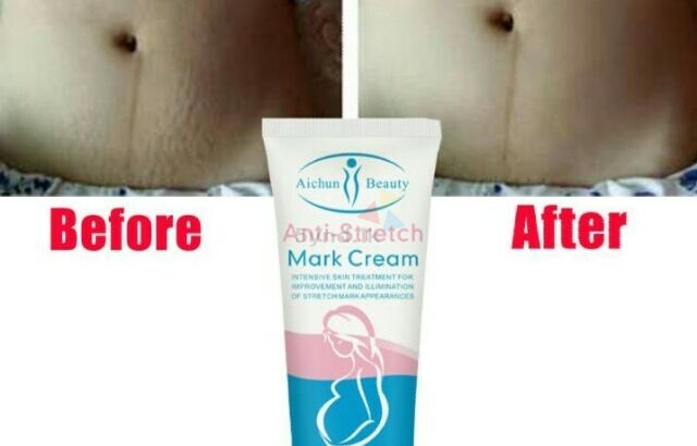 Aichun Beauty Anti Stretch Mark Cream